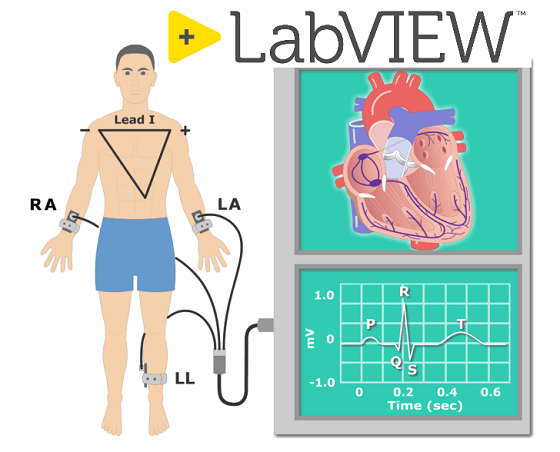 LabVIEW 心电图诊断系统